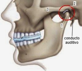 Dolor cervical oido y cabeza